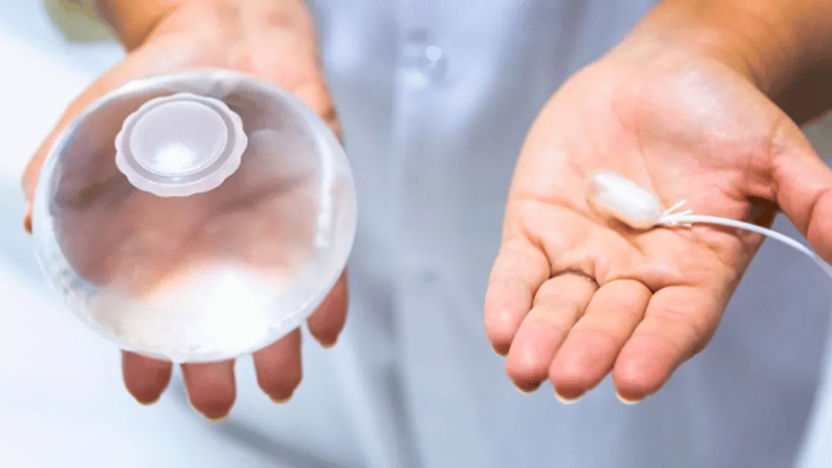 Gastric Balloon